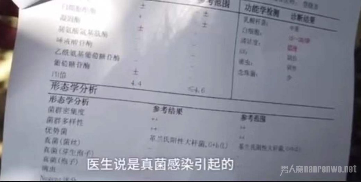 周女士真菌感染