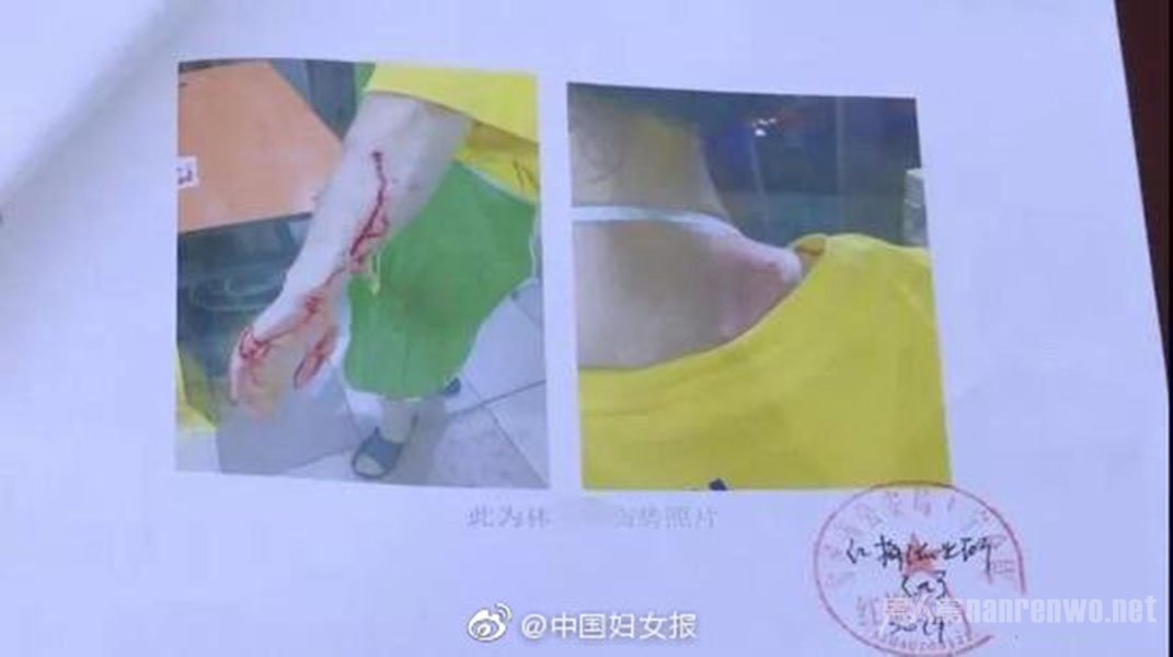 ������˱���Ҫ�����