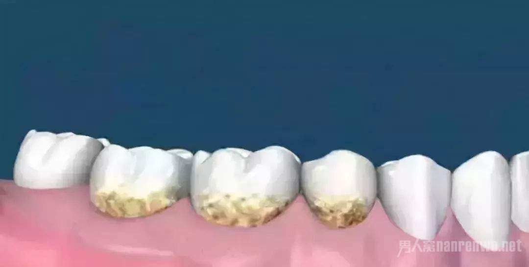 ʯķ