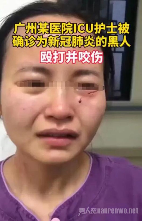 外籍新冠患者咬伤护士