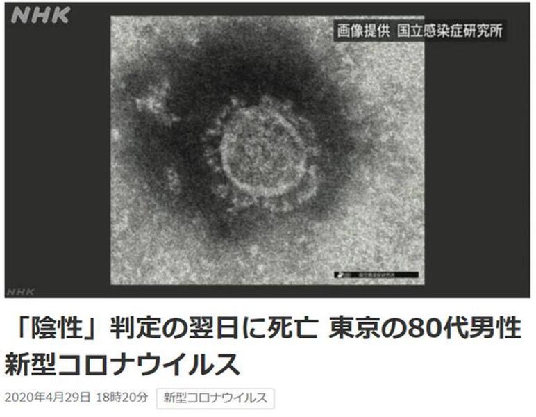 日本一感染者生前检测呈阴性